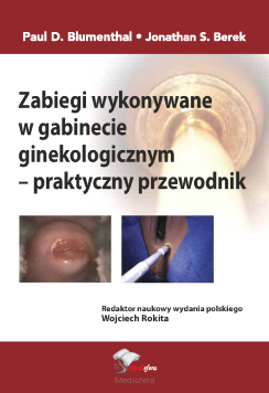 Zabiegi wykonywane w gabinecie ginekologicznym - praktyczny przewodnik