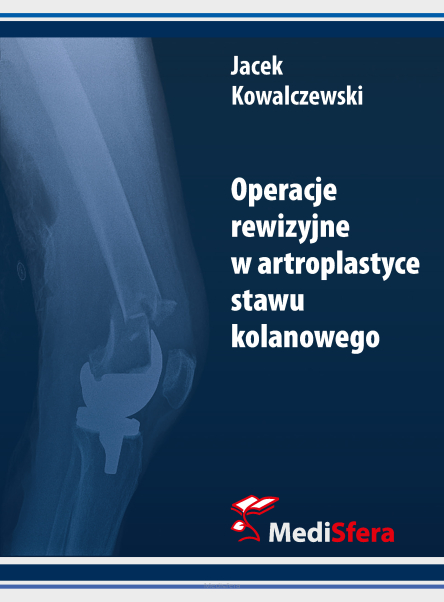 Operacje rewizyjne w artroplastyce stawu kolanowego
