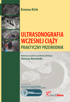 Ultrasonografia wczesnej ciąży