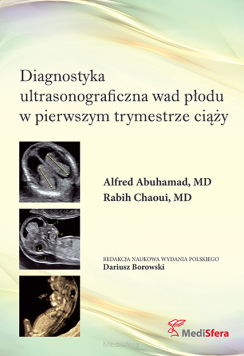 Diagnostyka ultrasonograficzna wad płodu w pierwszym trymestrze ciąży