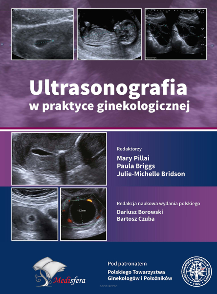 Ultrasonografia w praktyce ginekologicznej