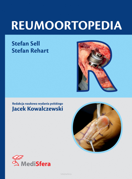 Reumoortopedia